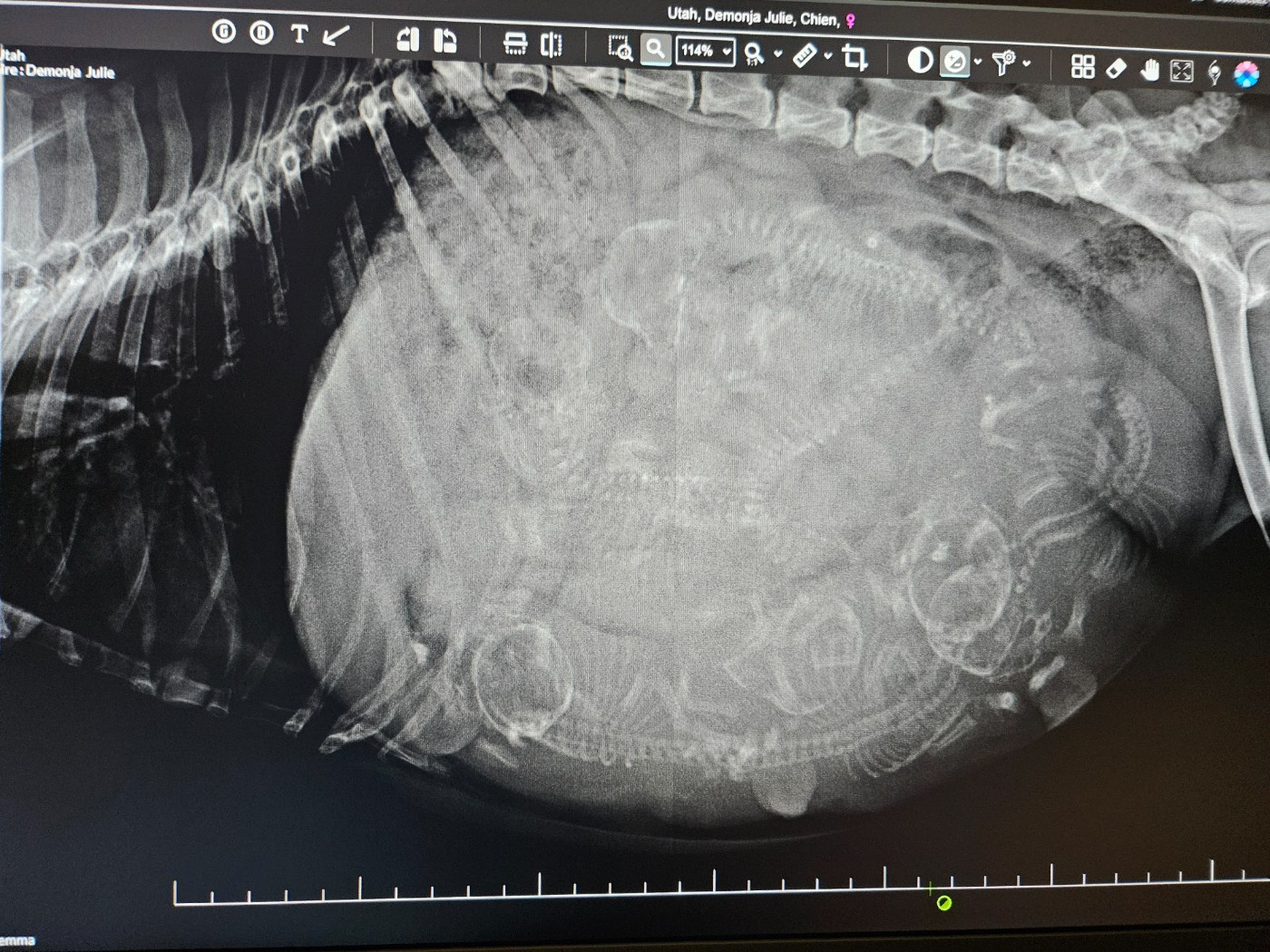 Radiographie de gestation